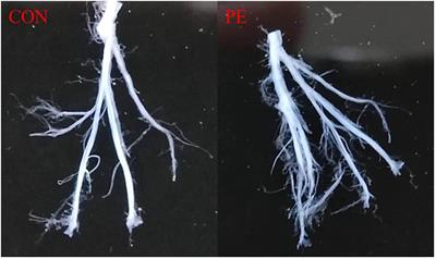 Transcriptomic profiling with vascular tension analyses reveals molecular targets and phenotypes in preeclamptic placental vasculature